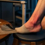 Photos algodystrophie pied : rougeur et œdème du pied